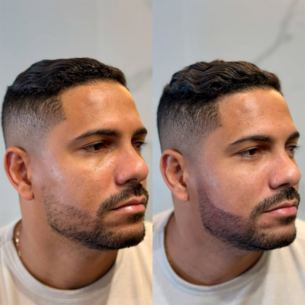 5depoimentos-micropigmentação-André